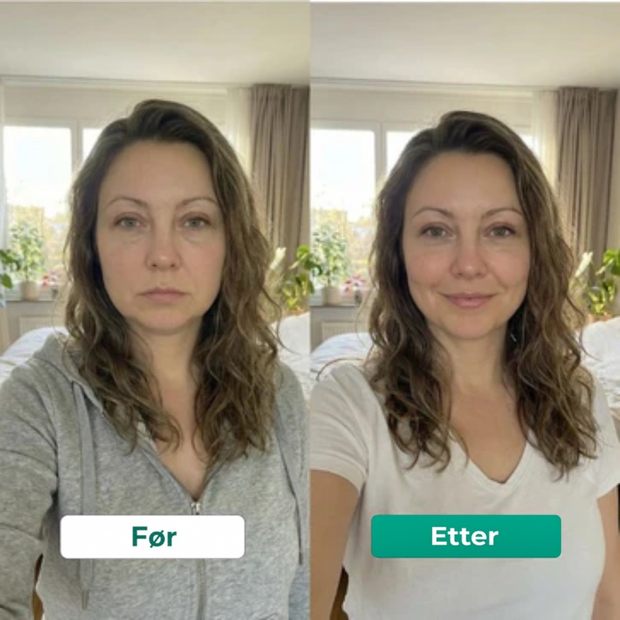 Før og etter